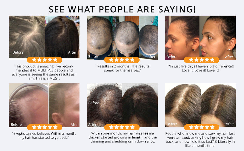 Thrive Growth Hair Essential Oil